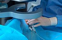 Laserowa korekcja wzroku bez tajemnic: Wszystko o FemtoLasik